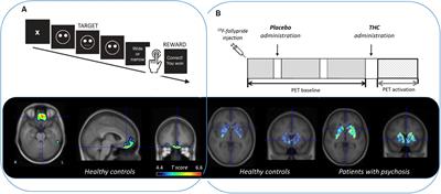 Methods for Quantifying Neurotransmitter Dynamics in the Living Brain With PET Imaging